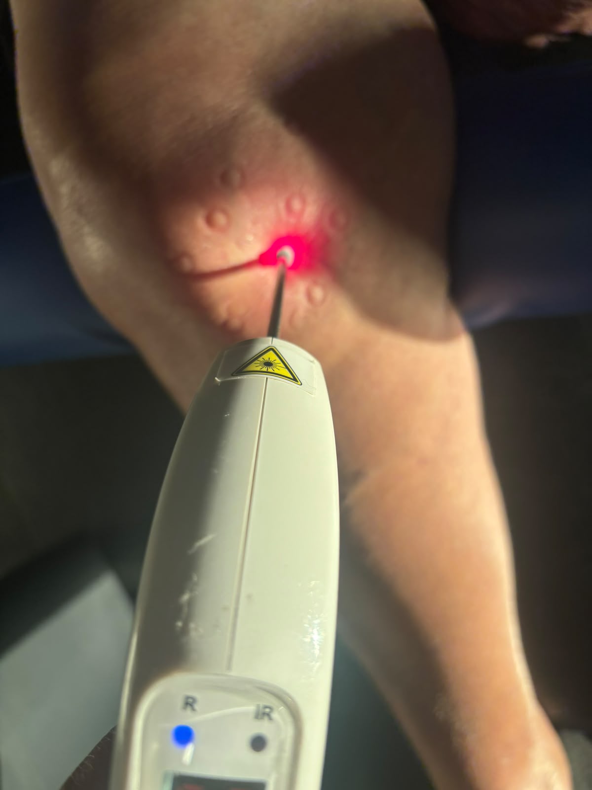 Laserterapia no Studio Halu Pilates